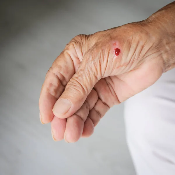 Mano anziana con sangue, incidente a casa . — Foto Stock