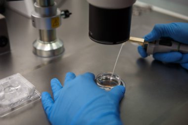 Tüp bebek kliniğinde Suni tohumlama işlemi. Mavi kauçuk eldiven eller Doktor üretmek kimyasal işleme laboratuarda mikroskop, tüpler, azot ile