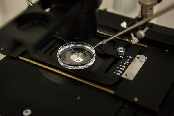 Equipo Laboratorio Clínica Fertilización Vitro Fiv Microscopio Tubos Nitrógeno Otros — Foto de Stock