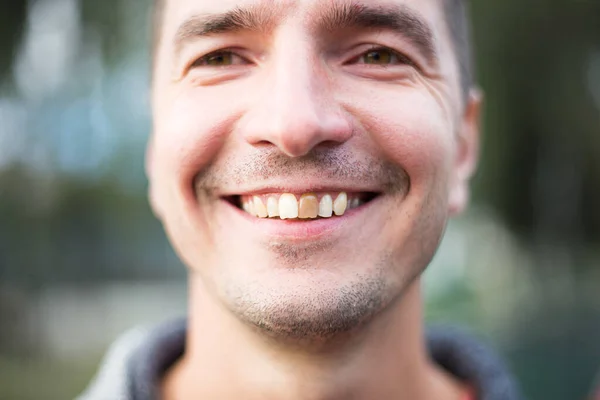 Yellow damaged tooth of a smiling Caucasian man in close-up. Focus on the teeth. Dental problems, dead teeth, enamel whitening, aesthetic restoration. Natural enamel, body positive, light unshaven