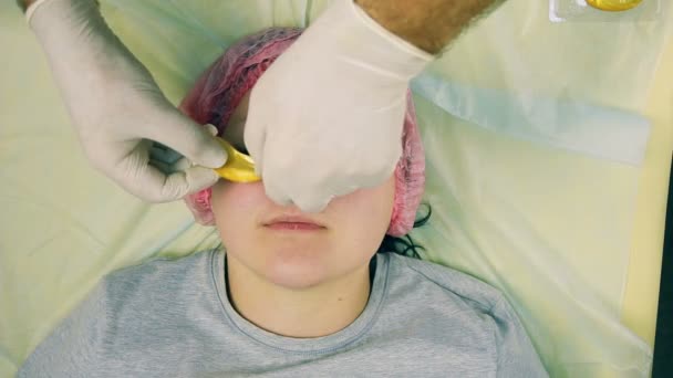 As mãos de um cosmetologista masculino em luvas impor almofadas de colágeno sob os olhos sobre a face das mulheres . — Vídeo de Stock