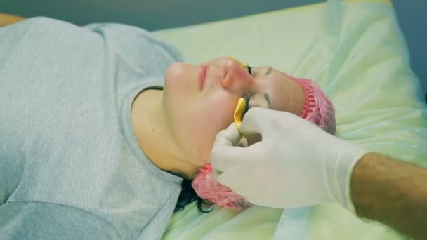 Händerna på manen av cosmetician i handskar bort från ansiktet av kvinna kollagen kuddar under ögonen — Stockvideo