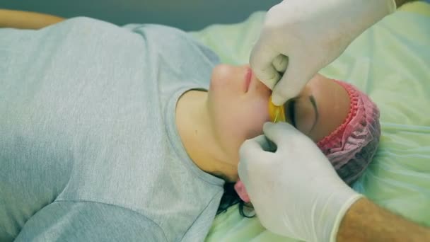 Tangan seorang kosmetologis laki-laki dalam sarung tangan memaksakan bantalan kolagen di bawah mata pada wajah wanita . — Stok Video