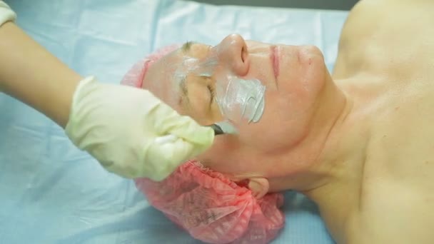 Een vrouwelijke schoonheidsspecialist in handschoenen geldt een behandeling masker voor een man s gezicht met een borstel. Zijaanzicht — Stockvideo