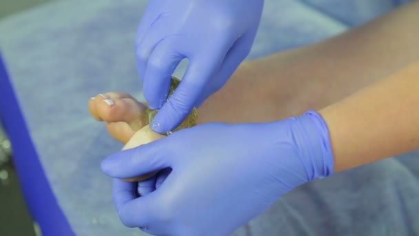 Ruce bijicijské ženy vyjmou vlasy z nohou dívky s cukrovou vložkou pomalý pohyb. — Stock video