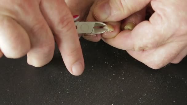 A kezében egy ember használja az eszközt, hogy távolítsa el fájó körmök rugalmasan a lábujjak — Stock videók