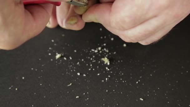 Man Snijdt Teennagels Besmet Met Schimmel Gereedschap Het Gemiddelde Plan — Stockvideo