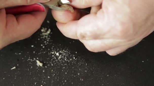 The hands of a man use the tool to remove sore nails flexibly on the toes — Stock Video