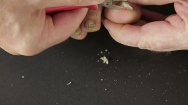Bir adam mantar aracı ile enfekte ayak tırnakları keser