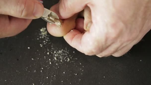 Mãos masculinas ferramenta corta unhas dos pés do fungo com fungo . — Vídeo de Stock