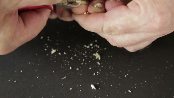 Man gereedschap snijdt schimmel teennagels met schimmel. — Stockvideo