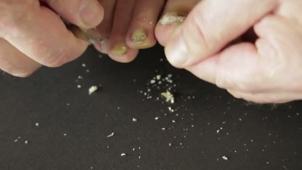 Man cuts toenails infected with fungus tool — Stock Video