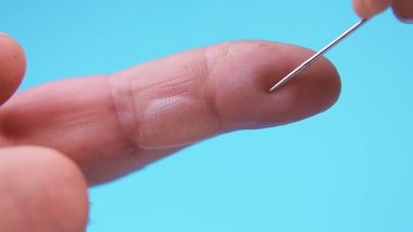 Bir elin parmaklarında bir yanık olur ve bir sıvı dışarı çıkar.