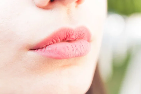 Close up female dry lips, health problems.