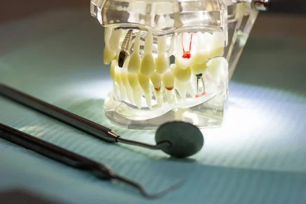 牙科工具设备模型模型口腔医学 — 图库照片