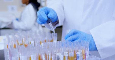 Kan plazması Kan Bankası 4 k Doktor bölümünü inceleyin