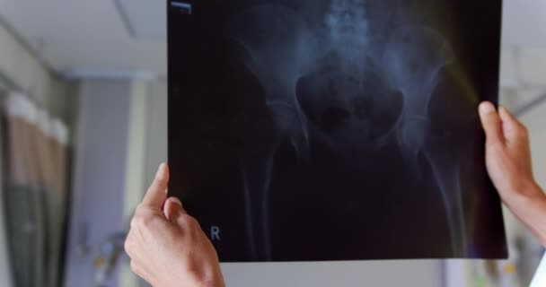 Вид Сбоку Вдумчивой Белой Женщины Врача Осматривающей Рентгеновский Отчет Палате — стоковое видео