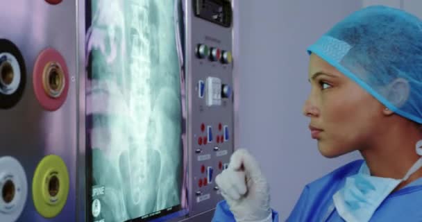 非裔美国女医生在医院的灯箱上看X光报告 她正在审查这份报告 — 图库视频影像