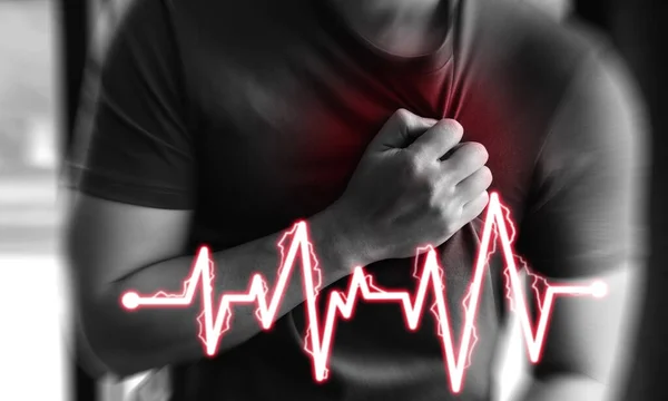 Kalp krizi. Adam akut ağrıdan göğsünü sıkıyor. Kalp krizi ya da ağrı sancısı geçiriyor. 