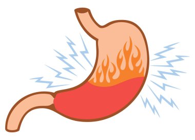 insan iç mide ekşimesi sorunları kavramı