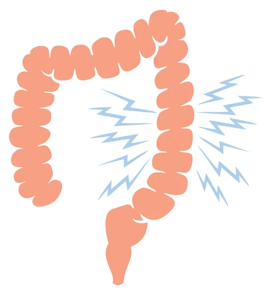 Probleem Met Menselijke Dikke Darm Vectorillustratie — Stockvector