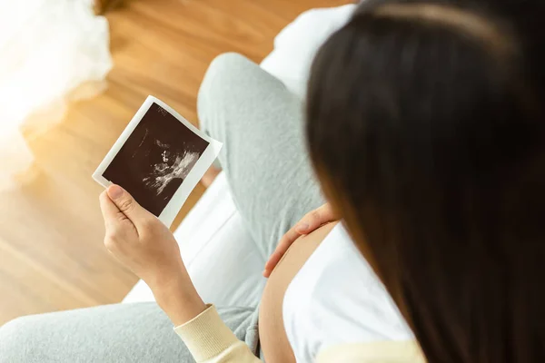 怀孕的亚洲母亲看着胎儿的超声或超声扫描照片 美丽的女人触摸着她的腹部 感觉到爱 或者非常欣赏她的婴儿或胎儿 怀孕坐在床上 选择性重点 — 图库照片