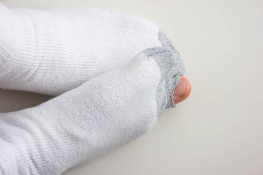 Kafkas erkek ayak parmağı aşınmış, kısa beyaz çoraplar ve delik manzaralı..