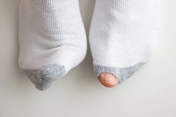 Caucásico Dedo Del Pie Masculino Que Sobresale Desgastados Calcetines Blancos —  Fotos de Stock