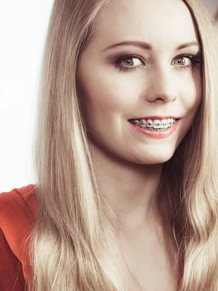 Tandarts Orthodontist Concept Elegante Volwassen Vrouw Glimlach Toont Haar Witte — Stockfoto