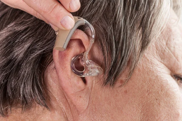 Femme Âgée Avec Prothèse Auditive Oreille Soins Santé Amplification Auditive — Photo