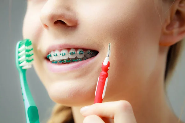 Концепція Стоматолога Ортодонта Молода Жінка Блакитними Брекетами Очищає Чистить Зуби — стокове фото