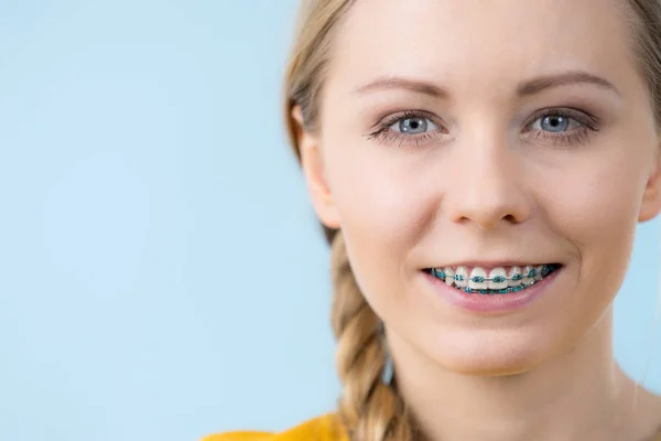 Tandarts Orthodontist Concept Vrouw Glimlach Tonen Haar Witte Tanden Met — Stockfoto