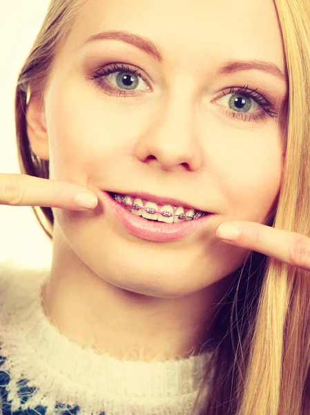 牙医牙科治疗概念 幸福微笑的女人 指着她的牙齿上的牙齿矫正 — 图库照片