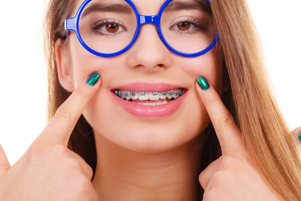 ビジョンと歯科問題のコンセプトです 幸せなダサい眼鏡歯彼女のブレースを表示の十代 — ストック写真