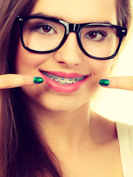 Dentist Orthodontist Concept Nerdy Geek Woman Wearing Big Eyeglasses Smiling Stock Image