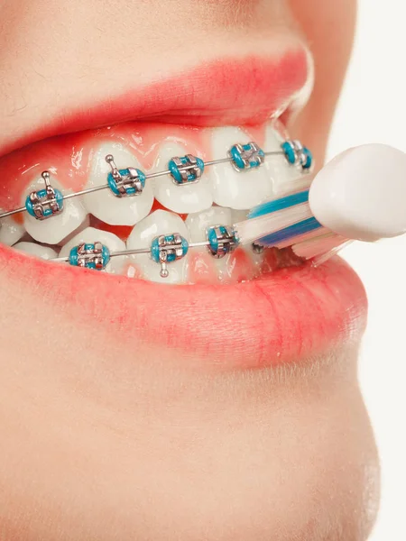 Dentist Orthodontist Concept Young Woman Smiling Cleaning Brushing Teeth Blue — Stock Photo, Image