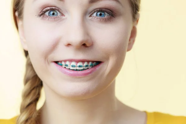 Dentysta Ortodonta Młoda Kobieta Nastolatek Dziewczyna Uśmiech Pokazując Zęby Niebieski — Zdjęcie stockowe