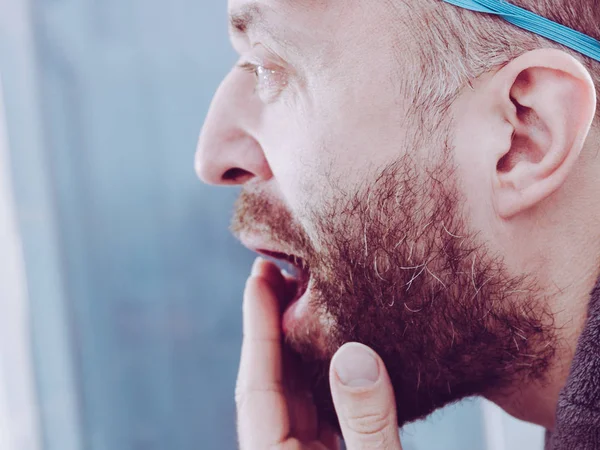 Funny Adult Man Wearing Eyemask Forhead Having Troubles Waking Standing — Stock Photo, Image