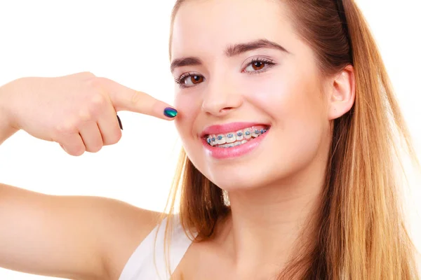 歯科医や歯科矯正医の概念 若い女性の笑顔青いブレースを有する歯を見せ — ストック写真