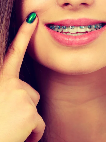 Concepto Dentista Ortodoncista Mujer Sonrisa Mostrando Sus Dientes Blancos Con — Foto de Stock