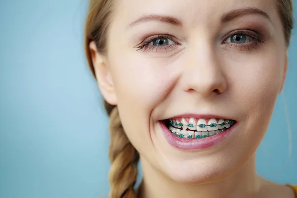 Primo piano di denti donna con bretelle, faccia divertente — Foto Stock