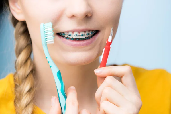 Mujer sonriendo limpiando dientes con aparatos ortopédicos — Foto de Stock