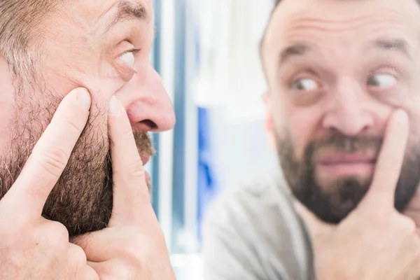 Un homme qui regarde des boutons sur son visage — Photo