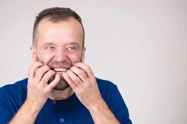 Mann beißt sich in die Nägel — Stockfoto