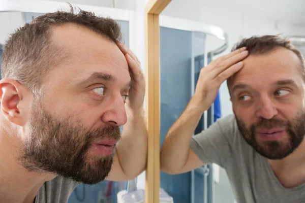 Занепокоєний чоловік дивиться на свою лінію зі зменшенням волосся — стокове фото
