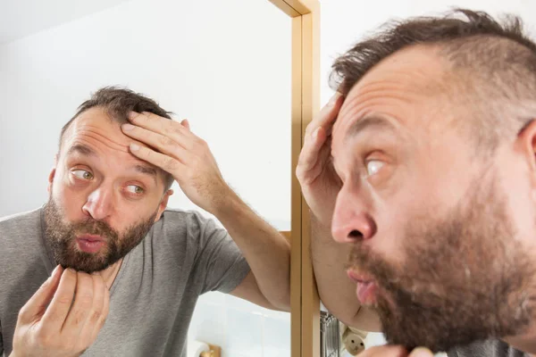 Uomo preoccupato guardando la sua linea decrescente dei capelli — Foto Stock