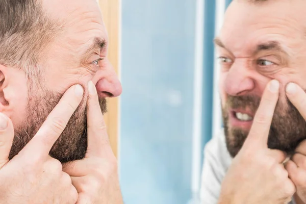 Un homme qui regarde des boutons sur son visage — Photo