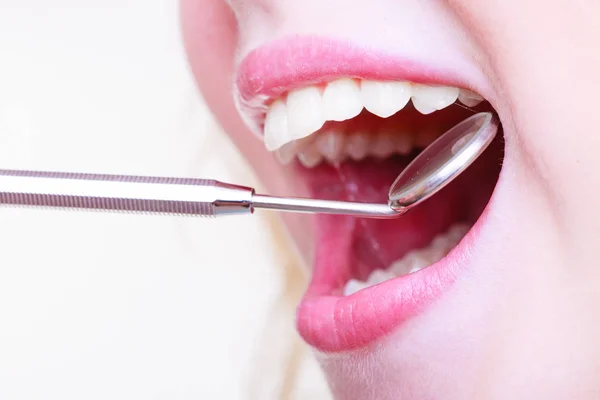 Woman teeth and dentist mouth mirror — Stock Photo, Image
