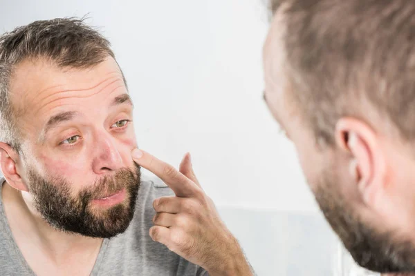 L'uomo che guarda le rughe sul viso — Foto Stock