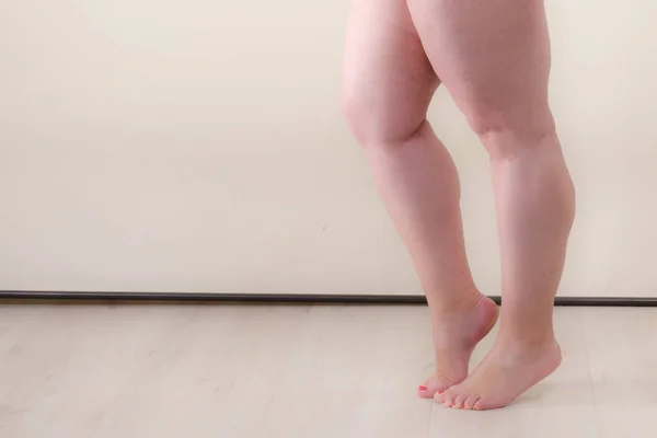 Mujer Adulta Gorda Además Tamaño Femenino Piernas Solamente Cuerpo Grande —  Fotos de Stock